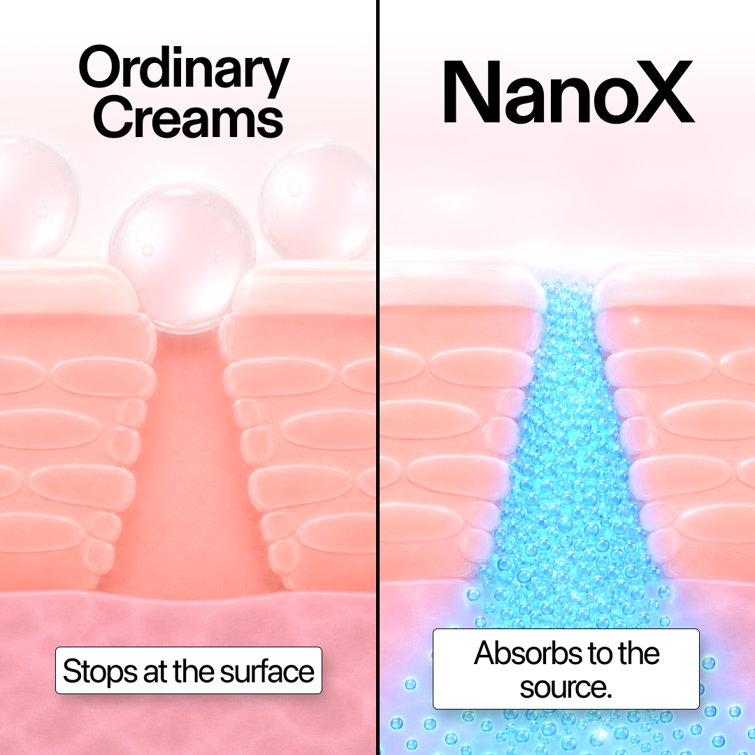 NanoXtreme Pain-Relief Cream | Maximum Strength 3.3oz